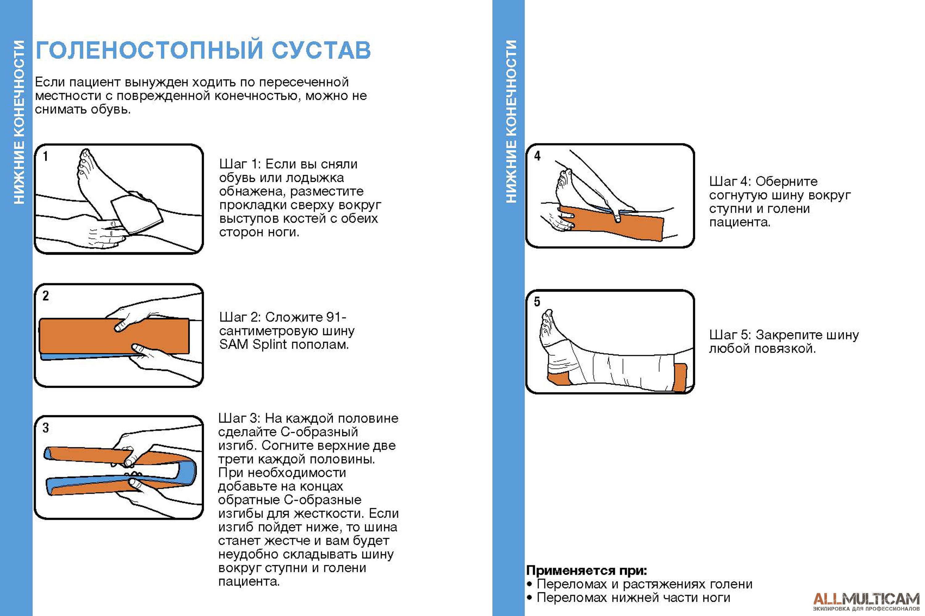 Как наложить шину 65 Как наложить шину 46
