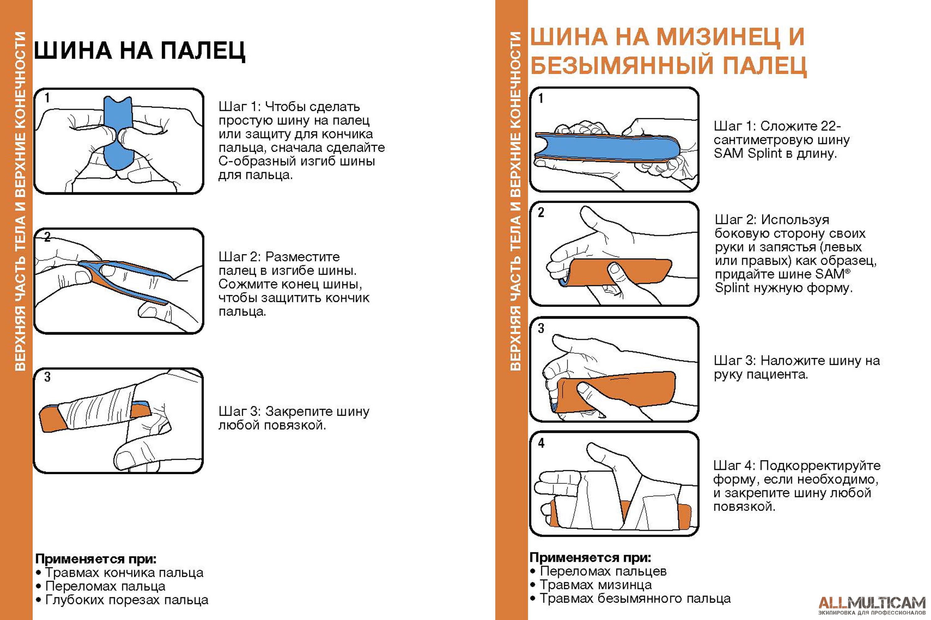 Шина Sam Splint - это самая популярная экстренная шина в мире