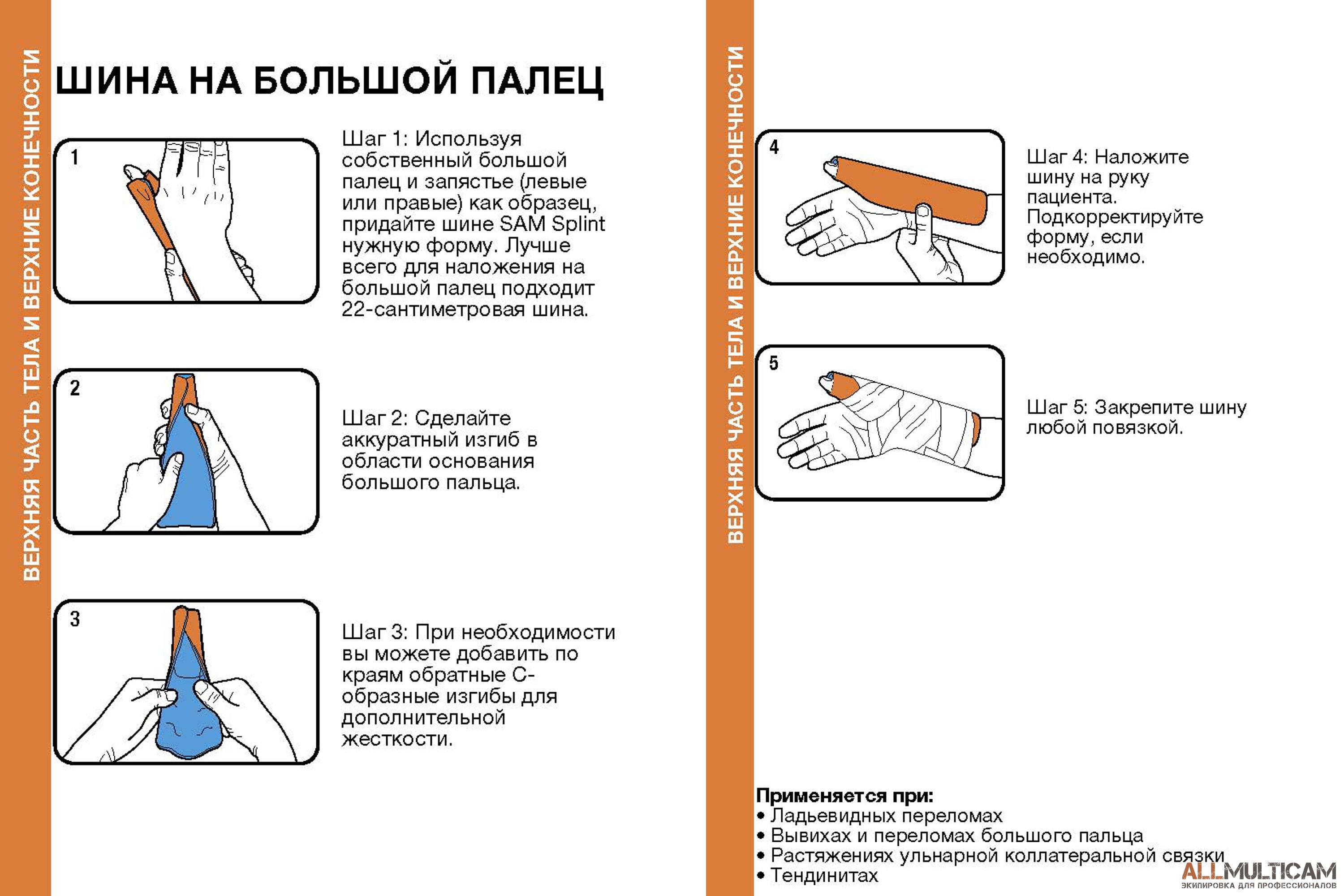 Шина Sam Splint - это самая популярная экстренная шина в мире