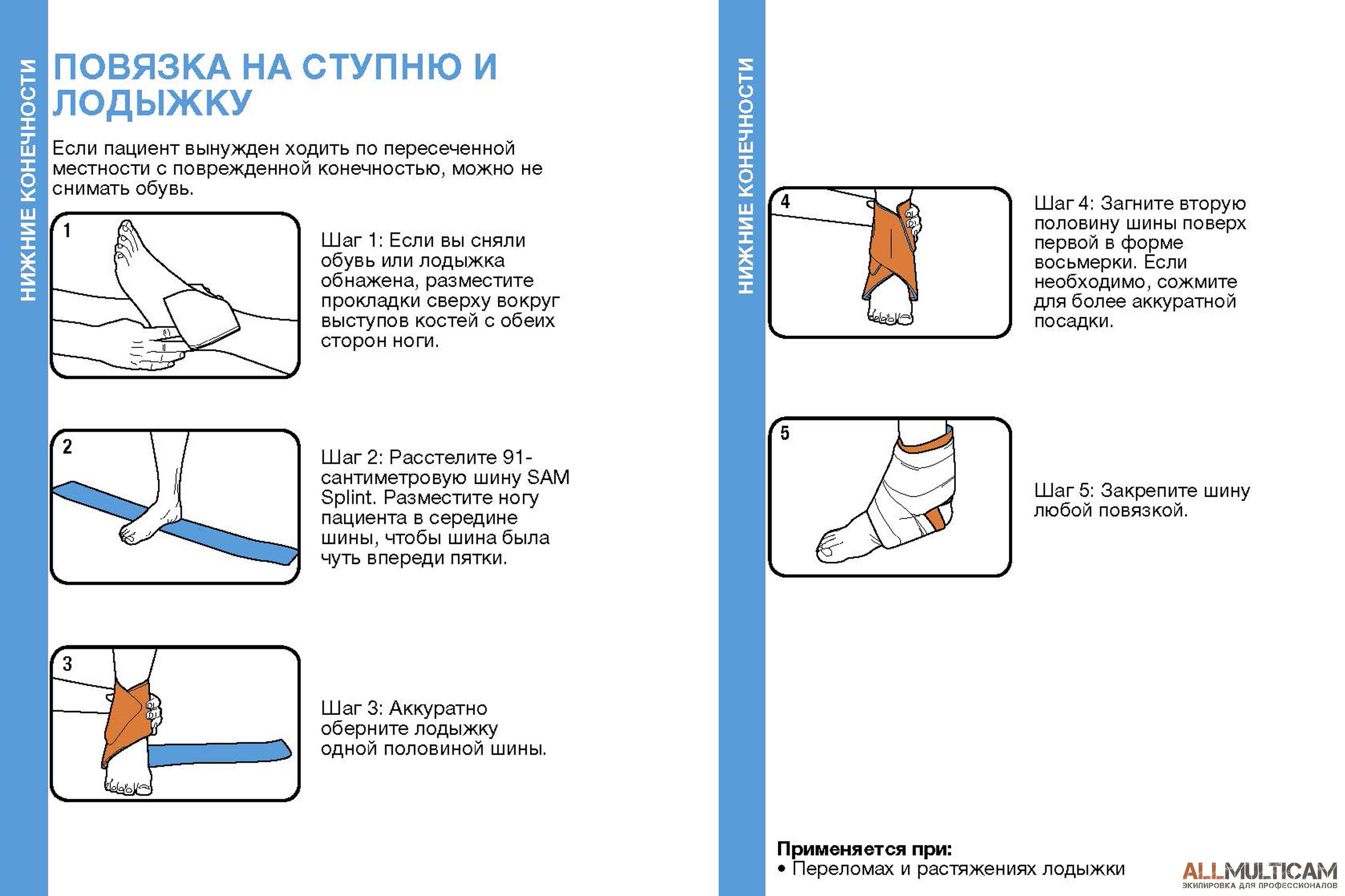 Шина Sam Splint - это самая популярная экстренная шина в мире