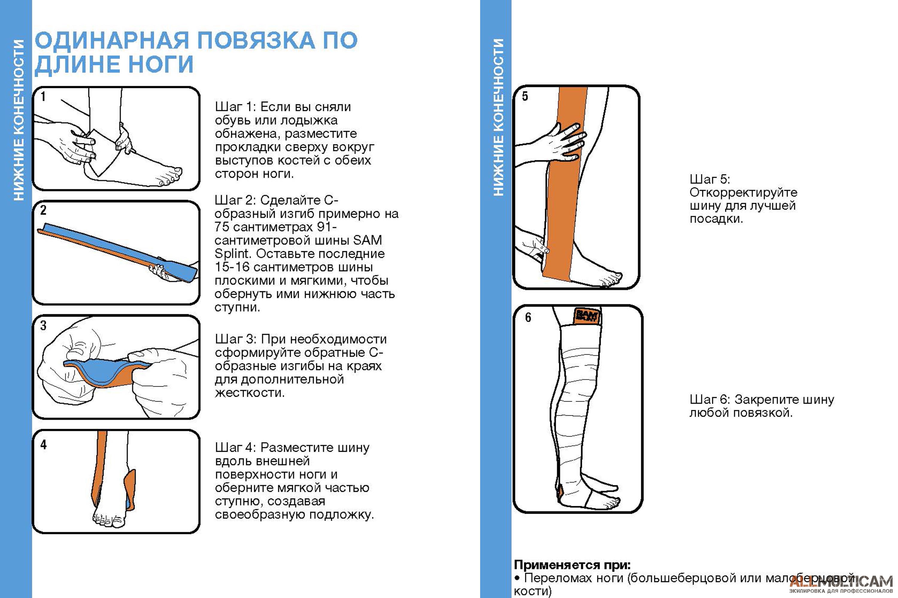 Шина Sam Splint - это самая популярная экстренная шина в мире