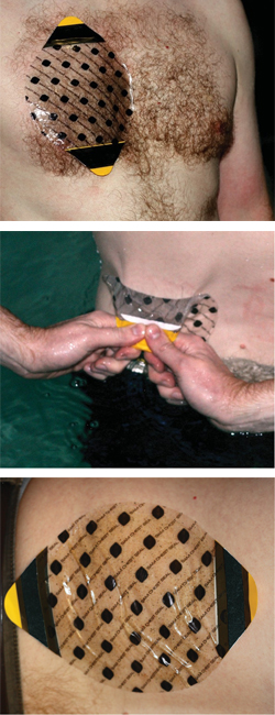 Пластырь при проникающих травмах груди SAM Chest Seal