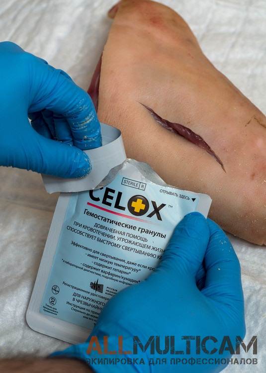 Обзор гемостатических средств Celox