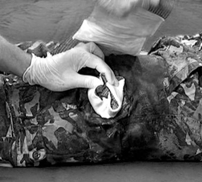 Эластичный марлевый бинт с клапаном давления, мобильной подушкой и петлевой ручкой (10 х 17 см) FCP07 First Care | Военторг ALLMULTICAM 