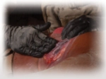 Прозрачный клейкий пластырь (6х6 дюймов) HyFin Chest Seal North American Rescue