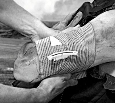 Эластичный марлевый бинт с клапаном давления и петлевой ручкой (15 х 18 см) FCP02 First Care | Военторг ALLMULTICAM 