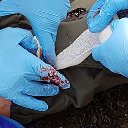 Бинты | Снаряжение и средства тактической медицины