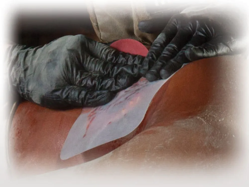Прозрачный клейкий пластырь (6х6 дюймов) HyFin Chest Seal North American Rescue